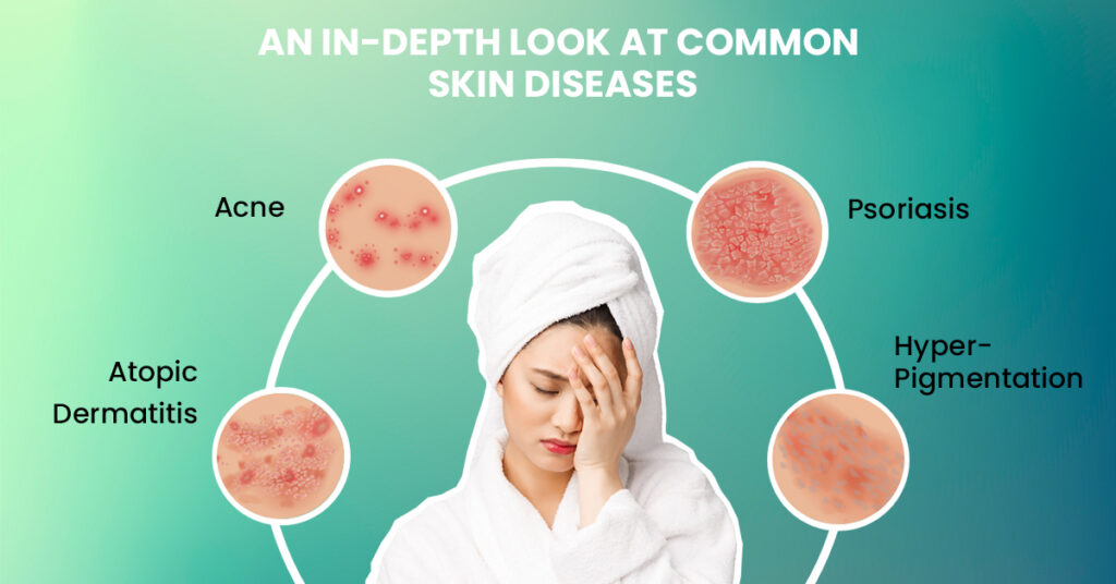 An In-depth Look Into Common Skin Diseases-dermatologists Singapore