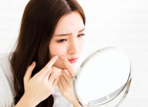 Adult acne treatments